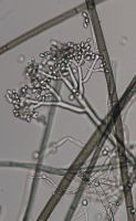 Konidiofor Botrytis cinerea z makrozarodnikami